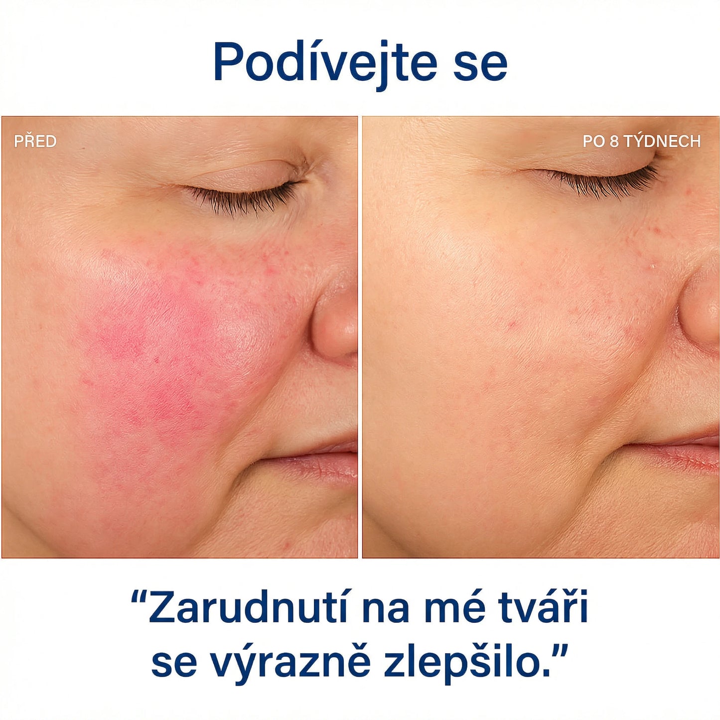 1 + 1 ZDARMA | HYDROLUXE Originál™ - Odstraňuje chlor a vodní kámen ze sprchy. Zvyšuje tlak vody, takže s každým použitím šetří vodu. (Dnes obsahuje 2 další filtry ZDARMA, na celý rok) Snadná a univerzální instalace.