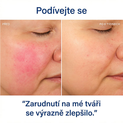 1 + 1 ZDARMA | HYDROLUXE Originál™ - Odstraňuje chlor a vodní kámen ze sprchy. Zvyšuje tlak vody, takže s každým použitím šetří vodu. (Dnes obsahuje 2 další filtry ZDARMA, na celý rok) Snadná a univerzální instalace.